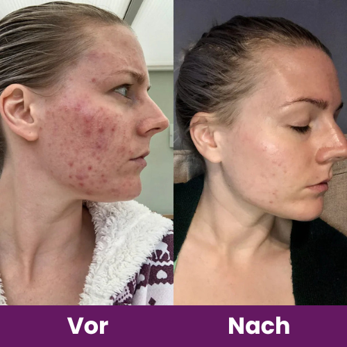 Femmelife Kollagen Kapseln