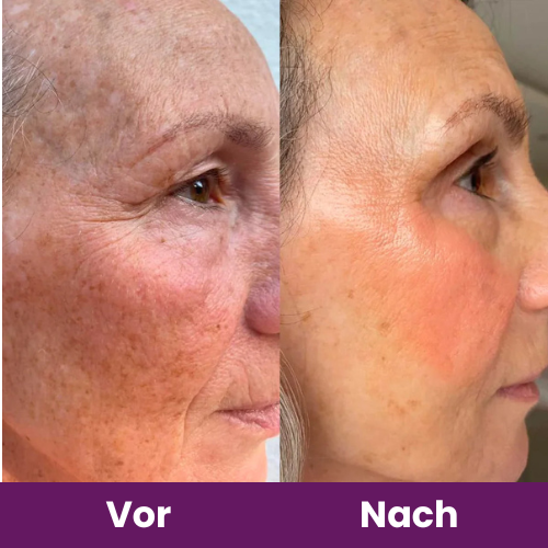 Femmelife Kollagen Kapseln