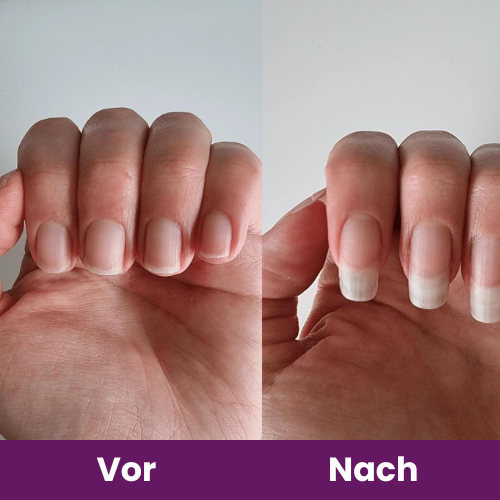 Femmelife Kollagen Kapseln